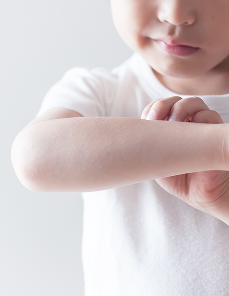 子どものあざ治療にも強みがあると伺いました。