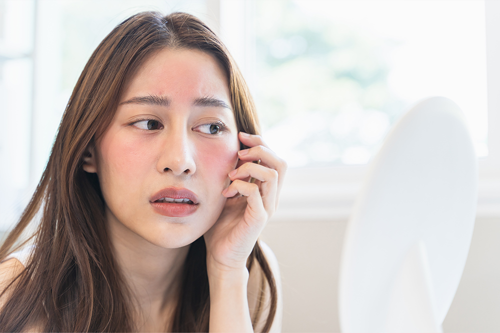 赤ら顔治療について