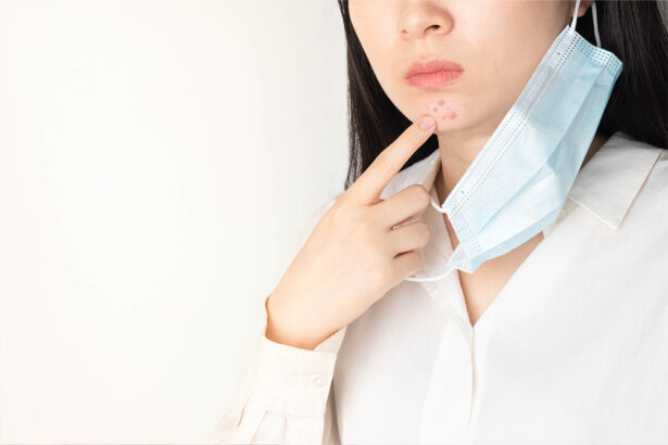 赤ら顔には主に2つのタイプがあります