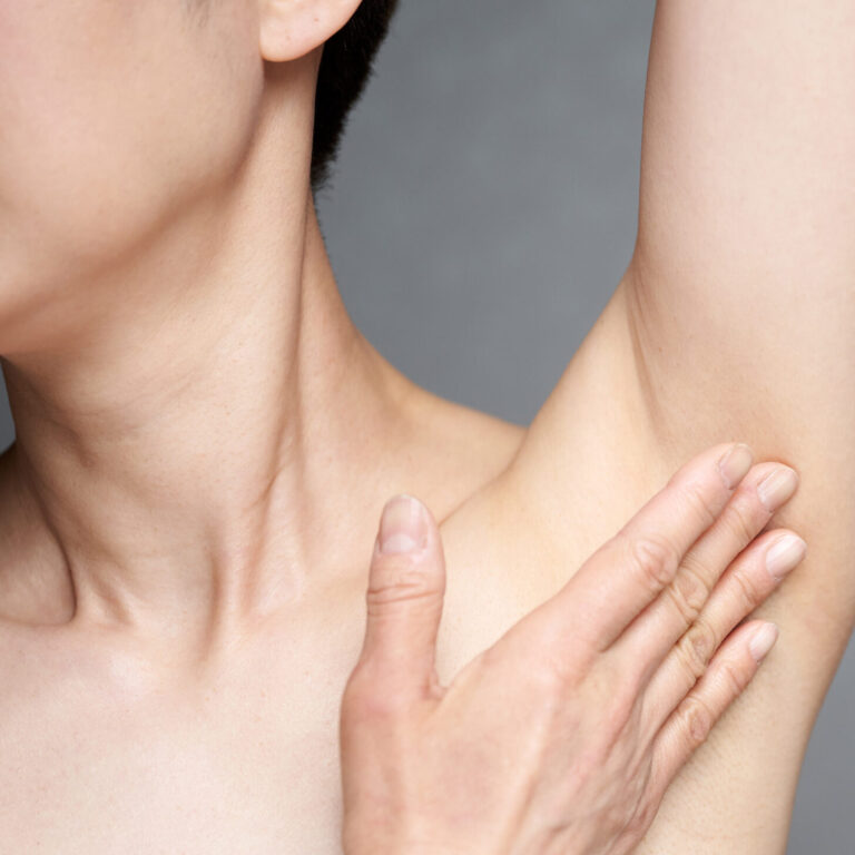 ミラドライは再発する？脇汗・ワキガが戻る原因と再施術の必要性を医療視点で解説